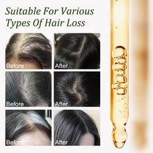 Load image into Gallery viewer, Gypsophila Batana Oil for Hair Growth -100% Pure Natural Hair Growth Oil, Nourishes The Scalp, Eliminates Split Ends, Reduce Hair Loss & Detox Your Scalp (2 Pack) for All Hair Types