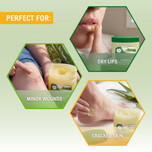 Load image into Gallery viewer, MED PRIDE Petroleum Jelly with Aloe Vera & Vitamin E, 13 oz – Skin Protectant and Moisturizing Ointment for Dry or Irritated Skin, Rashes, Chapped Lips, Minor Cuts, Burns and Diaper Rash