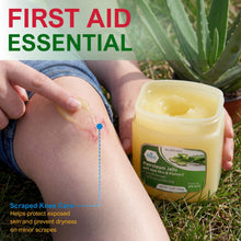 Load image into Gallery viewer, MED PRIDE Petroleum Jelly with Aloe Vera & Vitamin E, 13 oz – Skin Protectant and Moisturizing Ointment for Dry or Irritated Skin, Rashes, Chapped Lips, Minor Cuts, Burns and Diaper Rash
