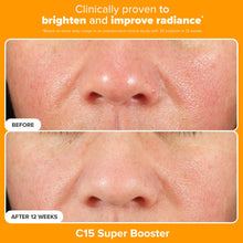 Load image into Gallery viewer, Paula's Choice Brighter Days Ahead Kit, Vitamin C and AHA Trio, Includes Travel Size C5 SPF Face Sunscreen, Mandelic Acid Exfoliant, C15 Vitamin C Booster Serum, Brightening & Resurfacing, 3-Piece Set