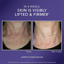Load image into Gallery viewer, RoC Crepe Repair Anti Aging Daily Face Moisturizer & Neck Firming Cream (1.7 oz) + RoC Retinol Wrinkle Smoothing Capsules (7 CT), Skin Care Treatment