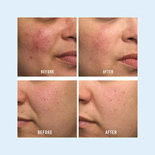 Load image into Gallery viewer, First Aid Beauty Ultra Repair Cream Intense Hydration Moisturizer for Face and Body - 6 oz.