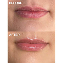 Load image into Gallery viewer, Lanolips 101 Ointment Multipurpose Superbalm Strawberry - Non-Greasy & Natural Salve with Lanolin for Chapped Lips, Dry Skin Patches & Cuticles - Non-Petroleum Based Balm Alternative (10g / 0.35oz)