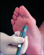 Load image into Gallery viewer, Neurotips Peripheral Neuropathy Examination Pins, White & Red, 100 Count