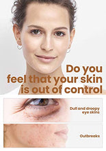 Load image into Gallery viewer, HOPEMATE Natural Facial Retinol Serum with Hyaluronic Acid& Vitamin E, New Skin Treatment Formula, Organic Anti Wrinkle Reducer, Anti Aging Moisturizer, Dark Circles, Scar, Sun Damage Corrector