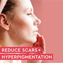 Load image into Gallery viewer, Organic Rosehip Seed Oil for Face - 100% Pure Cold Pressed Facial Oil, Reduces the Appearance of Scars, Natural Non-Greasy Moisturizing Serum for Dry and Sensitive Skin, 1 oz