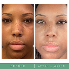 Load image into Gallery viewer, Replenix - Glycolix Elite Glycolic Acid Resurfacing Peel Pads - Medical Grade Brightening and Exfoliating Treatment, Travel Friendly Pads, 60 ct