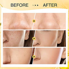 Load image into Gallery viewer, Turmeric Clay Stick Mask Organic Vitamin C Purifying Clay Mask Blackhead Cleansing Healing Clay Mud Mask Deep Clean Pore Improve Skin Acne Scars Facial Mask With Blackhead Remover Extractor ToolS