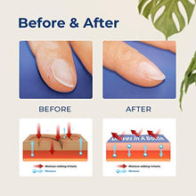 Load image into Gallery viewer, Gloves in a Bottle Shielding Lotion, Relief for Eczema and Psoriasis, (8 ounce)