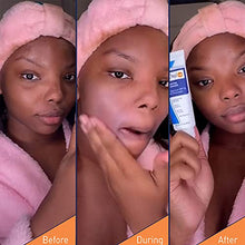 Load image into Gallery viewer, PanOxyl Oil Control Daily Moisturizer, Mattifying Lightweight Facial Moisturizer, Shine Control, Non Comedogenic, Won’t Clog Pores, SPF 30, 1.7 Oz