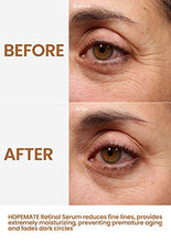 Load image into Gallery viewer, HOPEMATE Natural Facial Retinol Serum with Hyaluronic Acid& Vitamin E, New Skin Treatment Formula, Organic Anti Wrinkle Reducer, Anti Aging Moisturizer, Dark Circles, Scar, Sun Damage Corrector