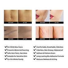Load image into Gallery viewer, AZALLY Advanced Scar Gel - Scar Diminishing Serum - Reduces the Appearance of Old & New Scars - Best Scar Treatment for Repair Scars from Burns Cuts Acne Spots Stretch Marks - 1oz.