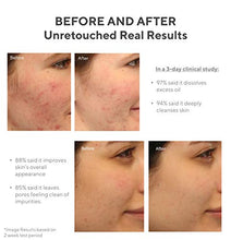 Load image into Gallery viewer, Murad Clarifying Cleanser - Acne Face Wash - Salicylic Acid Cleanser - Gentle Exfoliating Acne Treatment for Face, Prevents Future Breakouts, 6.75 Fl Oz