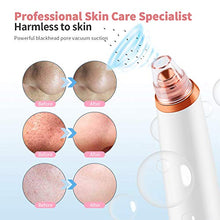 Load image into Gallery viewer, Blackhead Remover Vacuum Facial Acne Pore Suction Blackhead Vacume Cleaner Extractor Tool Face Comedone Removal with 6 Probes LCD Screen for Women & Men by Sunrich
