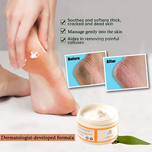 Load image into Gallery viewer, STRIDE Foot Cream Smoothes Rough & Dry Skin –– Dematologist-Developed, Intensely Moisturizing Foot Cream with Aloe Vera, Coconut oil and Green tea