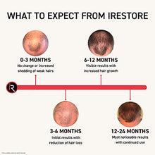 Load image into Gallery viewer, iRestore Professional Laser Hair Growth System - FDA Cleared Laser Hair Loss Treatments for Women and Hair Regrowth for Men with Balding, Thinning Hair