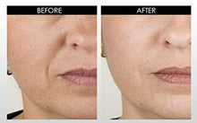 Load image into Gallery viewer, ANTI-AGING- MAGIC DMAE+MSM+NIACIN Firming Cream, 100% Pure Hyaluronic Acid, Argireline, Matrixyl 3000