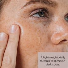 Load image into Gallery viewer, Dark Spot Corrector for Face - Dark Spot Remover Facial Serum, Hyperpigmentation Treatment, Skin Brightening Serum, Niacinamide Serum for Face, Kojic Acid, Tranexamic Acid, Fragrance Paraben Free, 100% Vegan