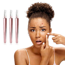 Load image into Gallery viewer, 3 Pieces Blackhead Tweezers Acne Blemish Stainless Steel Blemish Extractor Tool for Remove Blackhead Acne Whitehead Pimple Bend Curved Tweezer Skin Blackhead Remover Tools (Champagne Purple)