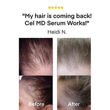 Load image into Gallery viewer, Cel Microstem Healthy Hair Growth Serum – Anti Thinning Hair Oil – Biotin Hair Serum - Thicker, Healthier Hair for Men & Women