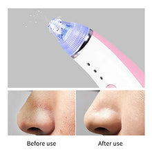 Load image into Gallery viewer, Mlikang Blackhead Remover Vacuum Suction Pore Cleaner, Blackhead Vacuum Extractor Tool Device Comedo Removal Suction Kit Electric Cleaning Tool Beauty Device for Women Men Face Nose