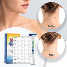 Load image into Gallery viewer, Pureskin Safe & Effective Formula Skin Tag Remover Patches Set, Skin Tag Removal Patches Set with Natural Ingredients for Your Skin Tag