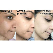 Load image into Gallery viewer, Original Kojie San Facial Beauty Soap - 100g, 3 Bars Per Pack - Guaranteed Authentic