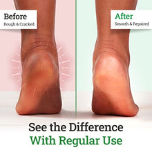 Load image into Gallery viewer, Remedy Tea Tree Oil Balm - Cream for Athletes Foot, Jock Itch, Ringworm, Eczema, Nail Issues, Rash, Skin Irritation - Ointment for Dry, Itchy Skin - Foot & Body Balm with Lavender & Eucalyptus - 2 Oz