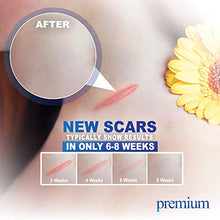 Load image into Gallery viewer, Premium Advanced Scar Gel Medical-Grade Silicone for Face, Body, Stretch Marks, C-Sections, Surgical, Burn, Acne | Old & New Scars, Clinically Proven | 30g