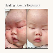 Load image into Gallery viewer, Evereden Healing Eczema Treatment, 1.7 fl oz & Evereden Nourishing Baby Face Cream 1.7 oz | 2 Item Bundle Set | Clean & Natural Skincare