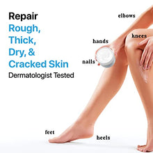 Load image into Gallery viewer, Urea Cream 40% Plus Salicylic Acid 4.6 Oz, Callus Remover Hand Cream Foot Cream For Dry Cracked Feet, Hands, Heels, Elbows, Nails, Knees, Intensive Moisturizes & Softens Skin, Exfoliates Dead Skin