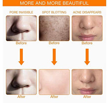 Load image into Gallery viewer, 7 Color Facial Mask | Photon Face Skin Care System | Healthy Smooth Skin Rejuvenation | Anti-Aging, Tightening, Toning, Wrinkle Acne Treatment | Collagen Restoring & Whitening Device