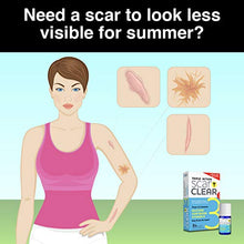 Load image into Gallery viewer, ScarClear Triple Action Scar Treatment .5oz
