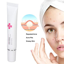 Load image into Gallery viewer, 15g Acne Removal Cream, Moisturizing Acne Scars Treatment Cream Skin Repairing Cream, Fades Acne Spot, stubborn Scars, Pigmentation & Blemish