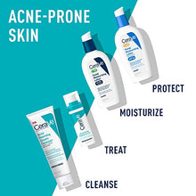 Load image into Gallery viewer, CeraVe Retinol Serum for Post-Acne Marks and Skin Texture | Pore Refining, Resurfacing, Brightening Facial Serum with Retinol | Fragrance Free & Non-Comedogenic| 1 Oz
