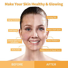 Load image into Gallery viewer, ANAIRUI Turmeric Vitamin C Face Mask, Clay Facial Mask with Vitamin C E for Radiant Skin, Acne Control and Refining Pores 4.05 Oz