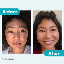 Load image into Gallery viewer, Proactiv+ 3 Step Advanced Skincare Acne Treatment - Benzoyl Peroxide Face Wash, Salicylic Acid Exfoliator for Face And Pore Minimizer - 30 Day Complete Acne Skin Care Kit