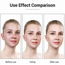 Load image into Gallery viewer, L E D Face Mask Light Therapy, 7 Colors Light Facial Mask for Skin Care, Light Therapy Mask for Facial Rejuvenation, Portable, Rechargeable, Wireless