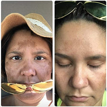 Load image into Gallery viewer, Admire My Skin Ultra-Potent Brightening Serum Dark Spot Corrector Remover 2% Hydroquinone Melasma Treatment Fade Cream with Kojic Acid Vitamin C, Salicylic Acid, Azelaic Acid, Lactic Acid Peel (1oz)