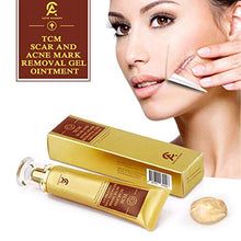 Load image into Gallery viewer, Scar Removal Cream For Old Scars- Stretch Mark Removal Gel for Men & Women- Stretch Marks Relief and Burns Repair,Face Skin Repair Gel