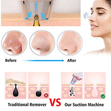Load image into Gallery viewer, Blackhead Vacuum Remover Pore Vacuum for face Electric Facial Acne Vacume Suction Cleanser Extractor .The device is Rechargeable and with 5 Probes for our blackheads dead skin cells dirt excess oil