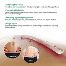 Load image into Gallery viewer, Scar Remover Cream, Reduce and Repair Skin, from C-Section, Acne, Surgery, Burns, Face Sacne, Effective for both Old and New Scars, Best Scar Removal Cream for Kids, Women, Men, 50Ml