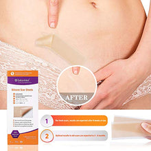 Load image into Gallery viewer, Silicone Scar Sheet, Scar Away, Scar Removal Treatment Sheet, 5.9'' x 1.6'',5 Pack, for Hypertrophic Scar,Keloid Scar,C-section Scar,Surgery Scar,Burn Scar, Acne Scar Removal Treatment by Ealionmed