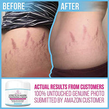Load image into Gallery viewer, Stretch Mark Cream for Pregnancy & Scar Removal - 100% Retinol Free - Mommy Knows Best Maternity Stretch Marks Cream Removal Treatment with Cocoa and Shea Butter - Clinically Proven - 4 fl oz