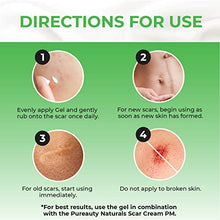 Load image into Gallery viewer, Scar Gel Reduce the Appearance of Old and New Scars - Acne, Burns, Cuts, Stretch Marks, C Section Marks & Plastic Surgery - Advanced Face and Body Formula, Men and Women Pureauty Naturals - 59ml