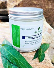 Load image into Gallery viewer, MSM Cream Rosacea Eczema Psoriasis Scars