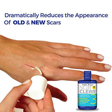 Load image into Gallery viewer, ScarClear Triple Action Scar Treatment .5oz