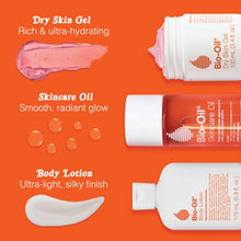 Load image into Gallery viewer, Bio-Oil Moisturizing Body Lotion for Dry Skin, Ultra-Lightweight High-Oil Hydration, with Jojoba Oil, Rosehip Oil, Shea Oil, and Hyaluronic Acid, 8.5 oz
