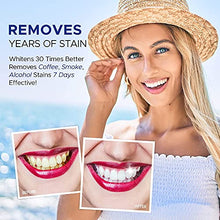 Load image into Gallery viewer, NOVOME Teeth Whitening Pen(2 Pcs), 20+ Uses, Effective & Painless, No Sensitivity, Travel-Friendly, Easy to Use, Natural Mint Flavor: Smile with Confidence, Beautiful White Smile!