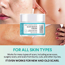 Load image into Gallery viewer, Scar Removal Cream, Scar Cream For Old Scars - Stretch Mark Removal Cream for Men & Women - Stretch Marks Relief and Burns Repair, Face Skin Repair Cream